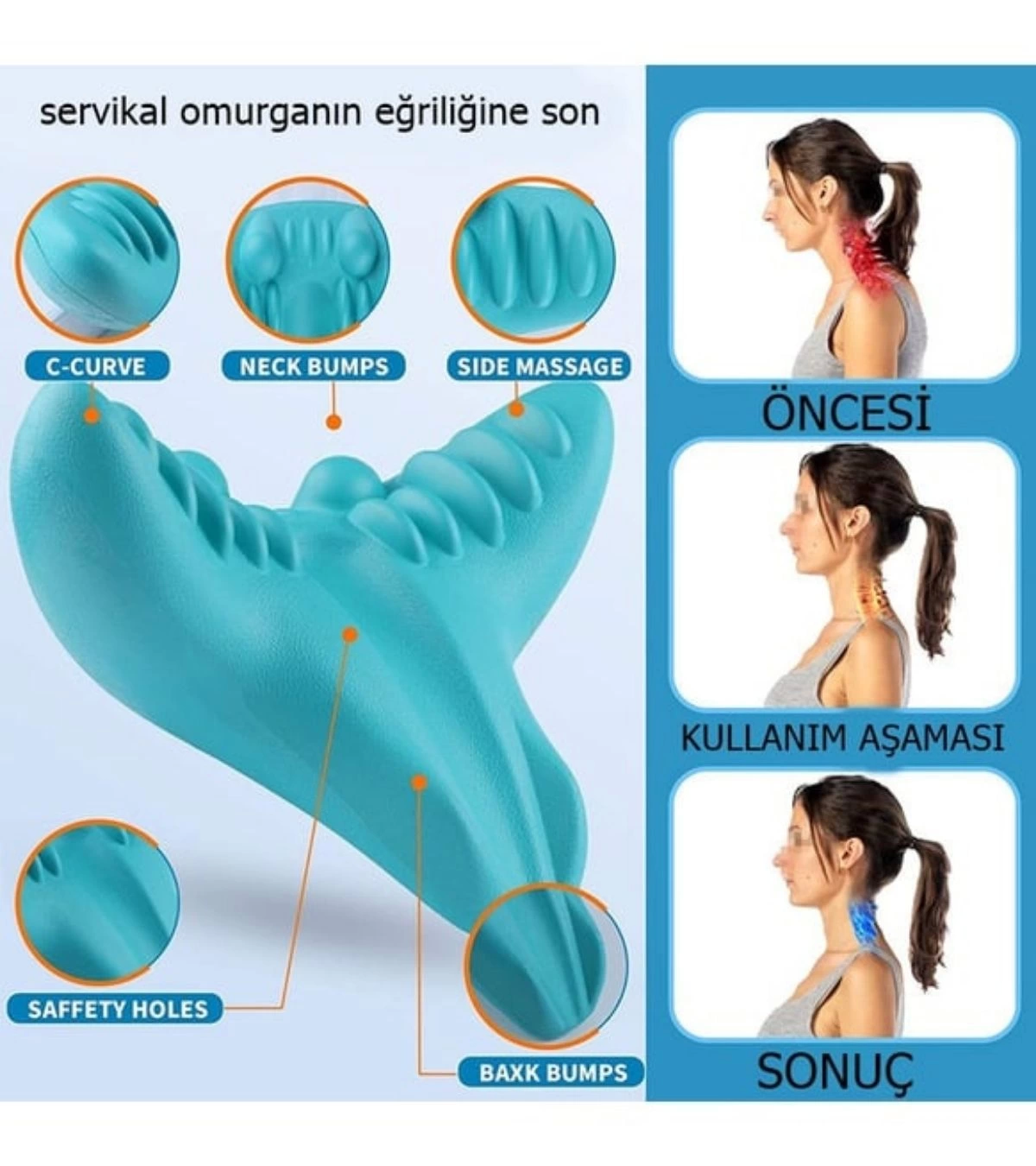 epilons-ergonomik-boyun-masaji-yastigi-servikal-traksiyon-destekli-agri-giderici-ortopedik-yapi-10953218-sw1200sh1350 Boyun Hörgücü ve Kamburluk Önleyen Ortopedik Yastık | Dik Duruş, Sağlıklı Omurga ve Rahat Uyku Desteği ( Vipsepet ) - Görsel 1